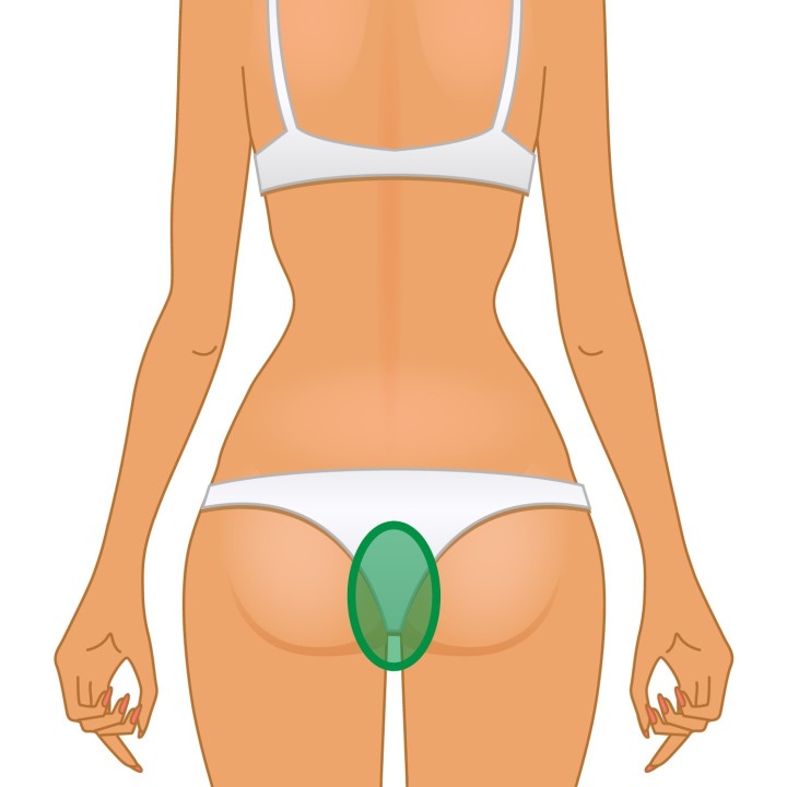 INTERNO GLUTEI - Cera